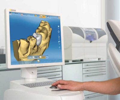 cerec-3D-full.jpg